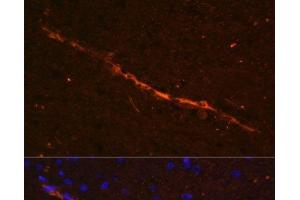 Immunofluorescence analysis of Rat brain using CD34 Polyclonal Antibody at dilution of 1:100. (CD34 antibody)