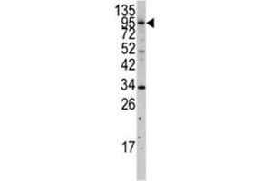 Western Blotting (WB) image for anti-Myosin Light Chain Kinase 3 (MYLK3) (AA 40-69) antibody (ABIN3031919)