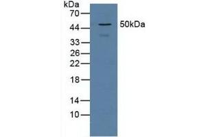 Detection of PSMD5 in Human Jurkat Cells using Polyclonal Antibody to Proteasome 26S Subunit, Non ATPase 5 (PSMD5) (Proteasome 26S Subunit, Non ATPase 5 (AA 143-341) antibody)