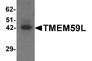 Western blot analysis of TMEM59L in rat heart tissue lysate with TMEM59L antibody at 1 µg/mL. (TMEM59L antibody  (C-Term))