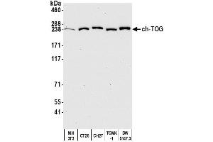 Western Blotting (WB) image for anti-Cytoskeleton Associated Protein 5 (CKAP5) (AA 1425-1475) antibody (ABIN7450110)