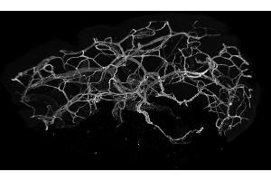 Immunofluorescence analysis of entire human skin, optically cleared with BABB, using CD31 (2MAC4, 2PEC47, 3MAC24, 3MAC69, 3MAC82, 3PEC82, 20 μg/mL) polyclonal LIMAAbody®, labelled with Alexa Fluor® 647 imaged on Zeiss LS7. (Recombinant CD31 antibody  (Extracellular Domain))