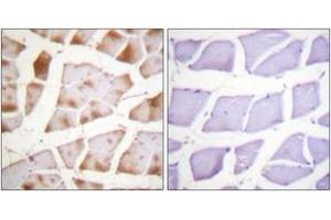 Immunohistochemistry analysis of paraffin-embedded human skeletal muscle tissue, using Actin-pan ( alpha/gamma)  (Ab-55/53) Antibody. (Actin antibody  (AA 21-70))