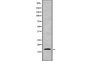 Western blot analysis of AP2S1 using HepG2 whole  lysates. (AP2S1 antibody  (N-Term))