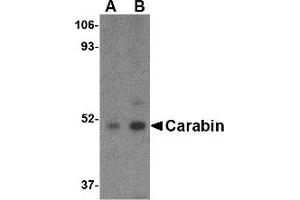 Image no. 1 for anti-TBC1 Domain Family, Member 10C (TBC1D10C) (C-Term) antibody (ABIN490812) (Carabin antibody  (C-Term))