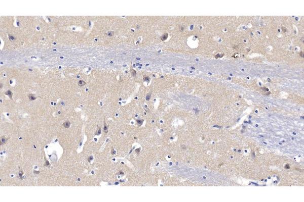 MMP25 antibody  (AA 108-313)
