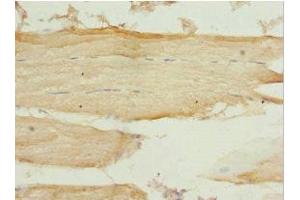Immunohistochemistry of paraffin-embedded human skeletal muscle tissue using ABIN7162990 at dilution of 1:100 (PEX7 antibody  (AA 1-240))