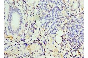 Immunohistochemistry of paraffin-embedded human pancreatic tissue using ABIN7156601 at dilution of 1:100 (IFNGR1 antibody  (AA 270-489))