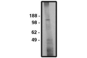Image no. 1 for anti-Solute Carrier Family 9 (Sodium/hydrogen Exchanger), Member 6 (SLC9A6) antibody (ABIN793709)