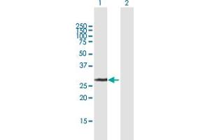 Western Blot analysis of UCK2 expression in transfected 293T cell line by UCK2 MaxPab polyclonal antibody. (UCK2 antibody  (AA 1-261))