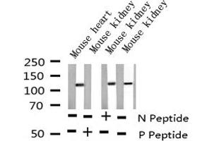 Western blot analysis of Phospho-NFAT4 (Ser165) expression in various lysates (NFATC3 antibody  (pSer165))