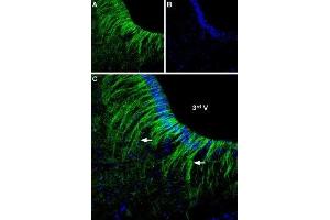 Expression of α2A-Adrenoreceptor in rat hypothalamus - Immunohistochemical staining of rat ventromedial hypothalamus free floating frozen section using Anti-α2A-Adrenergic Receptor (extracellular) Antibody (ABIN7042899, ABIN7043918 and ABIN7043919), (1:250). (ADRA2A antibody  (Extracellular, N-Term))