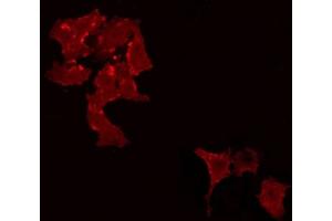 ABIN6266965 staining Hela by IF/ICC. (STON1 antibody  (C-Term))