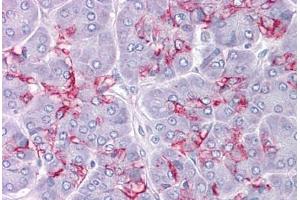 Human Pancreas: Formalin-Fixed, Paraffin-Embedded (FFPE) (Cathepsin K antibody  (AA 220-331))