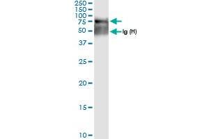 Immunoprecipitation of SGSH transfected lysate using anti-SGSH MaxPab rabbit polyclonal antibody and Protein A Magnetic Bead , and immunoblotted with SGSH MaxPab rabbit polyclonal antibody (D01) . (SGSH antibody  (AA 1-502))