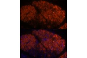 Immunofluorescence (IF) image for anti-Pancreatic Lipase-Related Protein 1 (PNLIPRP1) (AA 298-467) antibody (ABIN7269167)