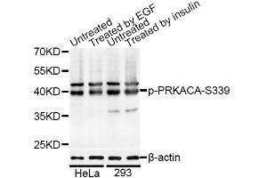 Western blot analysis of extracts of HeLa and 293 cells, using Phospho-PRKACA-S339 antibody (ABIN5995921) at 1/1000 dilution. (PRKACA antibody  (pSer339))