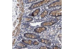 Immunohistochemical staining of human duodenum with SGEF polyclonal antibody  shows moderate cytoplasmic positivity in glandular cells as well as in the muscular layers. (SGEF antibody)