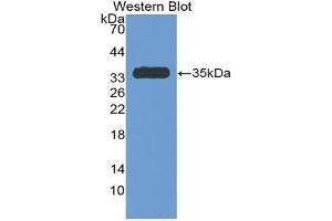 Detection of Recombinant Antithrombin, Rat using Polyclonal Antibody to Antithrombin (AT) (SERPINC1 antibody  (AA 150-426))