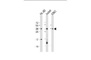All lanes : Anti-RSPO1 Antibody (C-Term) at 1:2000 dilution Lane 1: HL-60 whole cell lysate Lane 2: Jurkat whole cell lysate Lane 3: K562 whole cell lysate Lysates/proteins at 20 μg per lane. (RSPO1 antibody  (AA 206-240))