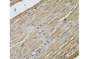 Immunohistochemistry of paraffin-embedded Rat heart using CDH16 Polyclonal Antibody at dilution of 1:100 (40x lens). (Cadherin-16 antibody)