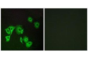Immunofluorescence (IF) image for anti-Transcription Termination Factor, RNA Polymerase II (TTF2) (Internal Region) antibody (ABIN1852442)