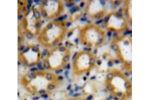 Used in DAB staining on fromalin fixed paraffin-embedded kidney tissue (TRAF6 antibody  (AA 254-475))