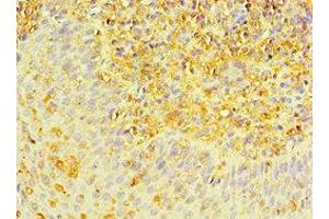 Immunohistochemistry of paraffin-embedded human tonsil tissue using ABIN7150706 at dilution of 1:100 (MAP2K3 antibody  (AA 1-170))
