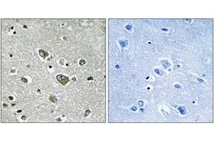 Immunohistochemistry analysis of paraffin-embedded human brain tissue, using ZDHHC9 Antibody. (ZDHHC9 antibody  (AA 315-364))