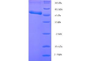 RuvB (AA 1-336), (full length) protein (His-SUMO Tag)