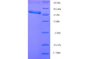 SDS-PAGE (SDS) image for RuvB (AA 1-336), (full length) protein (His-SUMO Tag) (ABIN5711109) (RuvB (AA 1-336), (full length) protein (His-SUMO Tag))