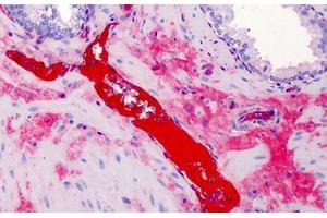 Anti-A2M / Alpha-2-Macroglobulin antibody IHC of human prostate. (alpha 2 Macroglobulin antibody)
