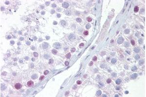 Immunohistochemistry with Testis tissue at an antibody concentration of 5µg/ml using anti-UTF1 antibody (ARP30063_P050) (UTF1 antibody  (Middle Region))