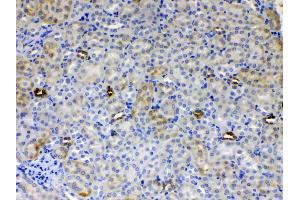 IHC analysis of ALDH1A3 using anti- ALDH1A3 antibody . (ALDH1A3 antibody  (AA 37-154))