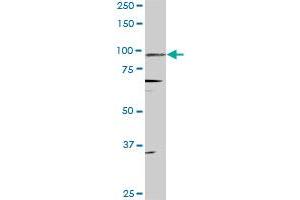 PGR monoclonal antibody (M08), clone 4E9. (Progesterone Receptor antibody  (AA 1-110))