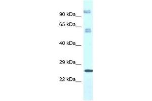 Western Blot showing TMEM222 antibody used at a concentration of 1. (TMEM222 antibody  (C-Term))