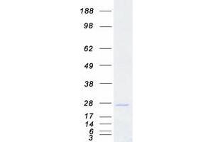 Validation with Western Blot (SNAP23 Protein (Transcript Variant 1) (Myc-DYKDDDDK Tag))