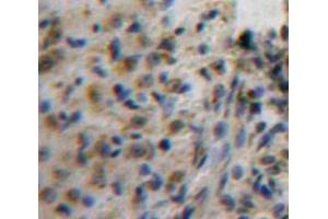 Used in DAB staining on fromalin fixed paraffin-embedded Ovary tissue (AFT1 antibody  (AA 3-213))