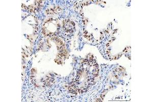 IHC analysis of DDX1 using anti-DDX1 antibody (ABIN7602052). (DDX1 antibody  (AA 562-740))