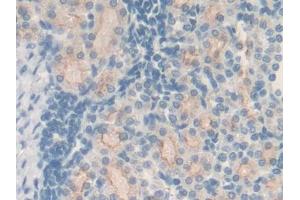 DAB staining on IHC-P; Samples: Rat Kidney Tissue (MT2 antibody  (AA 1-61))