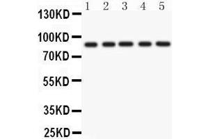 Anti- CD36 Picoband antibody, Western blotting All lanes: Anti CD36  at 0. (CD36 antibody  (N-Term))