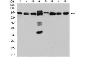 Western blot analysis using DDX1 mouse mAb against Hela (1), MCF-7 (2), A431 (3), PC-3 (4), NIH/3T3 (5), Jurkat (6), U251 (7), and HEK293 (8) cell lysate. (DDX1 antibody  (AA 642-740))