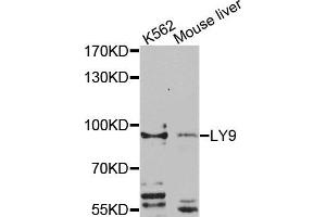 Western blot analysis of extracts of K562 and mouse liver cells, using LY9 antibody. (LY9 antibody)