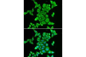 Immunofluorescence analysis of MCF7 cells using STRN3 antibody . (STRN3 antibody  (AA 200-460))