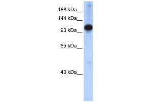 WB Suggested Anti-SMARCAL1 Antibody Titration:  0. (SMARCAL1 antibody  (N-Term))