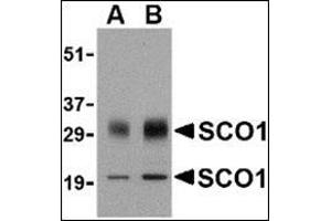 Western blot analysis of SCO1 in human brain tissue lysate with this product at (A) 0.