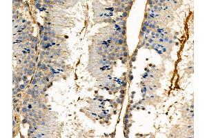 Phospho-PBK/TOPK (Ser32) Antibody at 1/100 staining Mouse testis tissue by IHC-P.