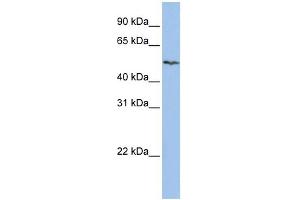 WB Suggested Anti-SLC16A6 Antibody Titration:  0. (SLC16A6 antibody  (Middle Region))