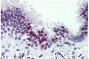Human Lung (formalin-fixed, paraffin-embedded) stained with CASZ1 antibody ABIN364232 at 5 ug/ml followed by biotinylated goat anti-rabbit IgG secondary antibody ABIN481713, alkaline phosphatase-streptavidin and chromogen. (CASZ1 antibody  (N-Term))