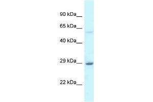 WB Suggested Anti-EIF6 Antibody Titration: 1. (EIF6 antibody  (C-Term))